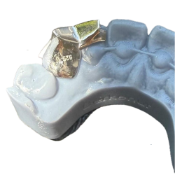 Gold Star Frame Grillz Z311