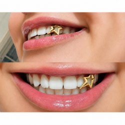Gold Star Frame Grillz Z311