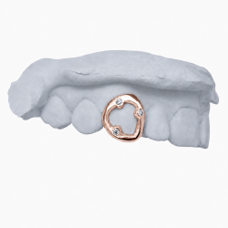 3 Stone Grillz Z355