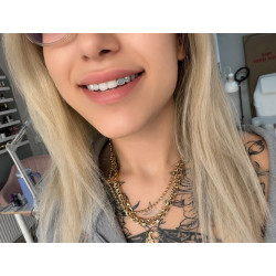 4 teeth Frame Grillz Z302