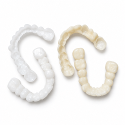 Snap On Smile, Snap on Veneers