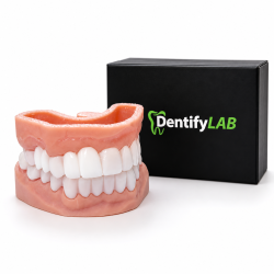 Snap On Smile, Snap on Veneers