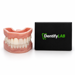 Snap On Smile, Snap on Veneers