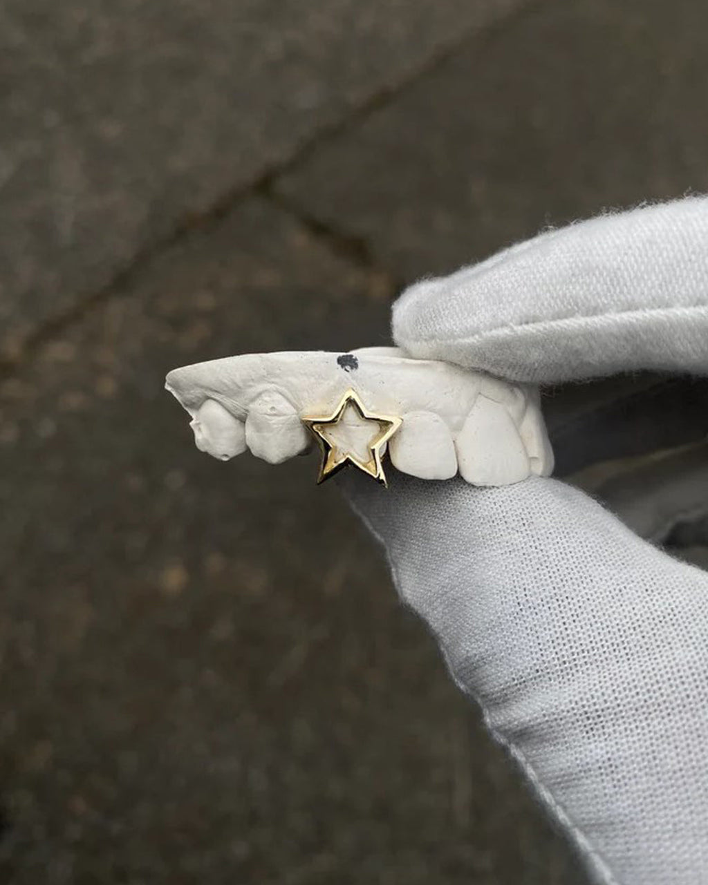 Custom Single Star Grillz