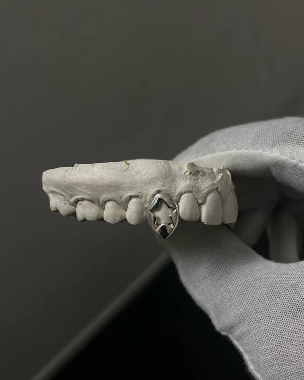 Custom Star Design Grillz