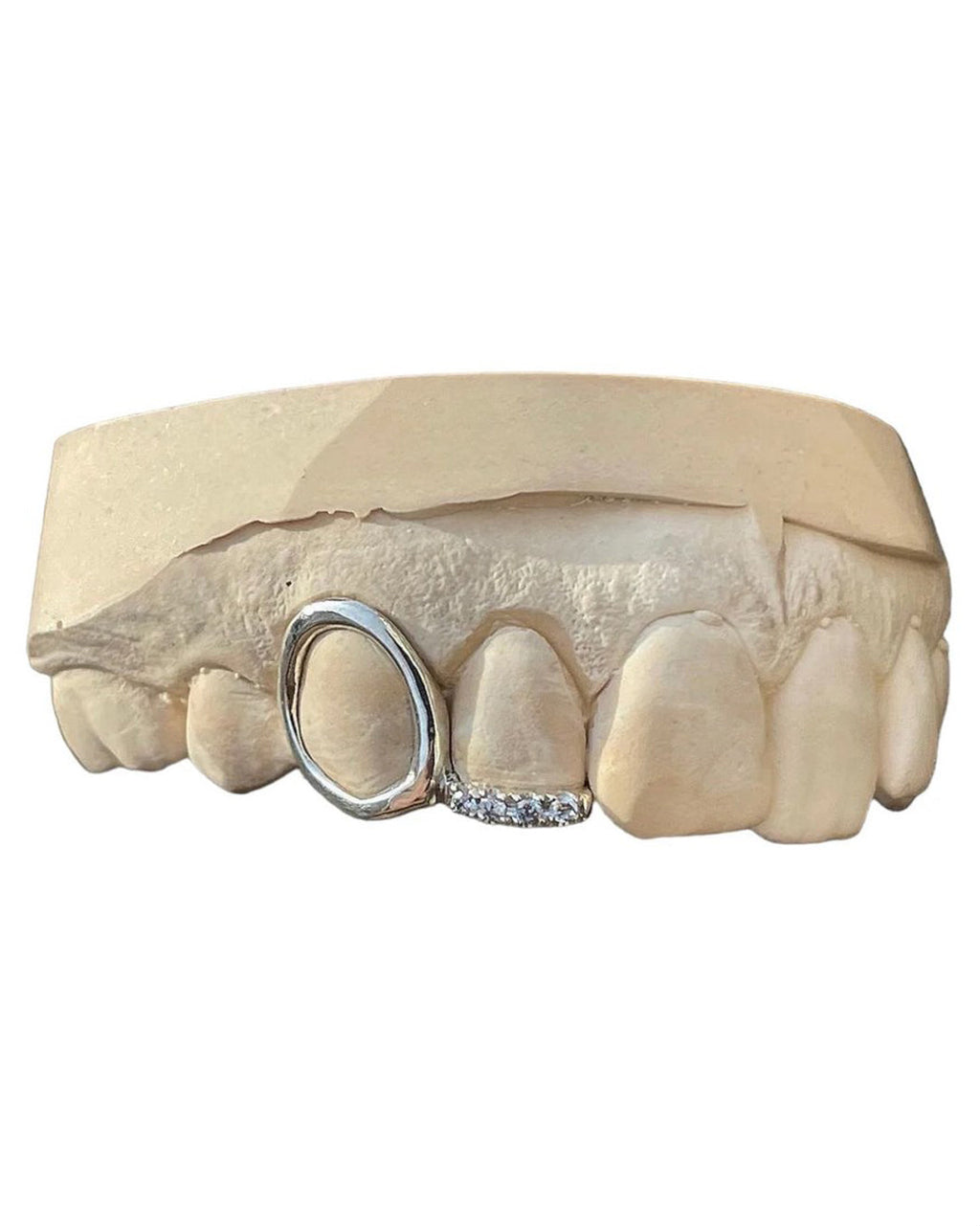 Custom Window Cap Grillz with Swarovski Gemstone