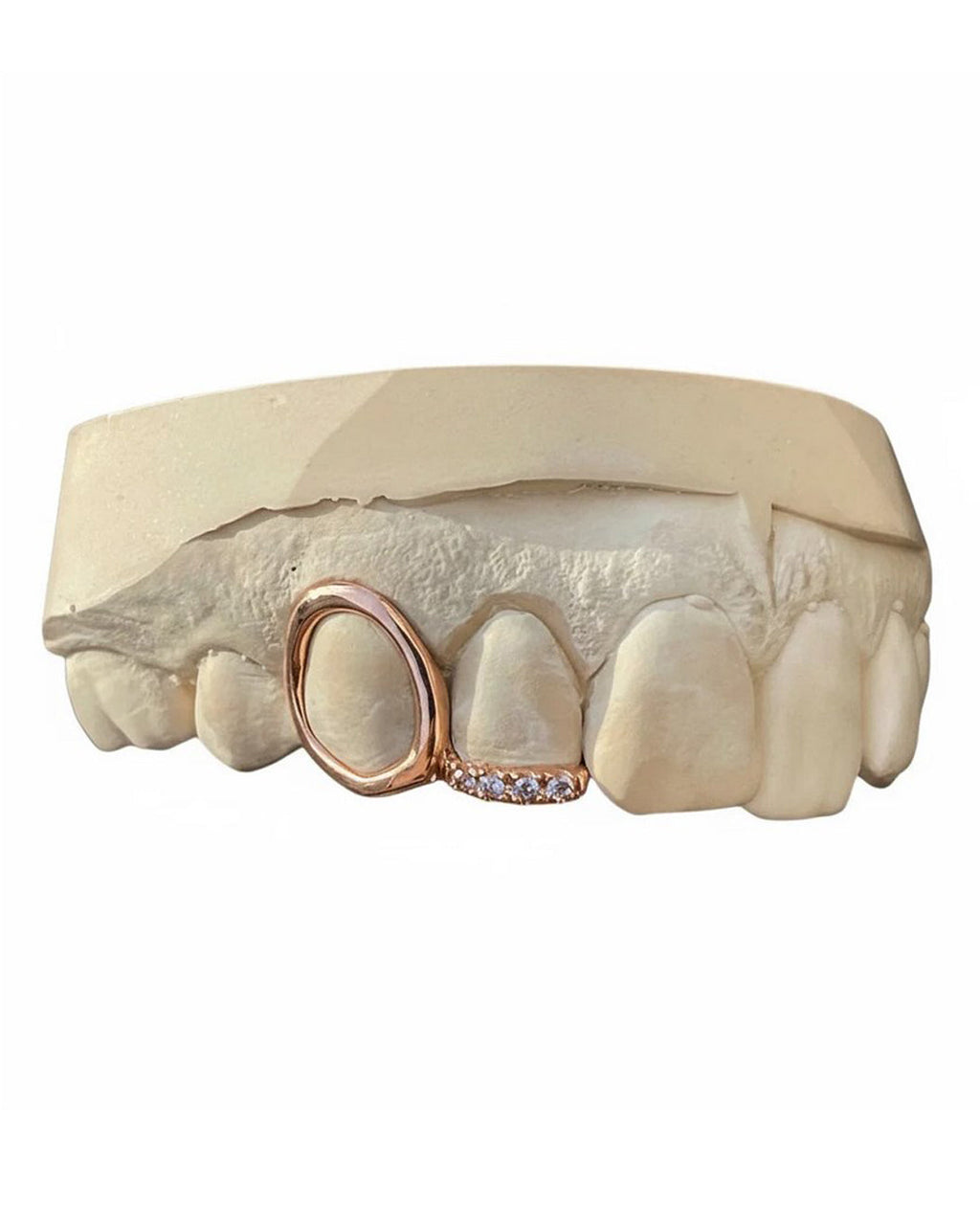 Custom Window Cap Grillz with Swarovski Gemstone
