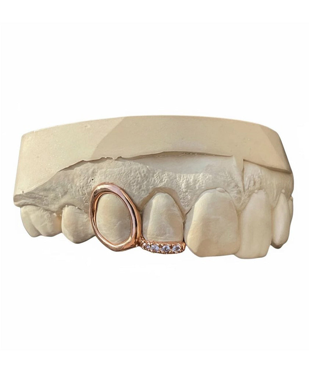 Custom Window Cap Grillz with Swarovski Gemstone