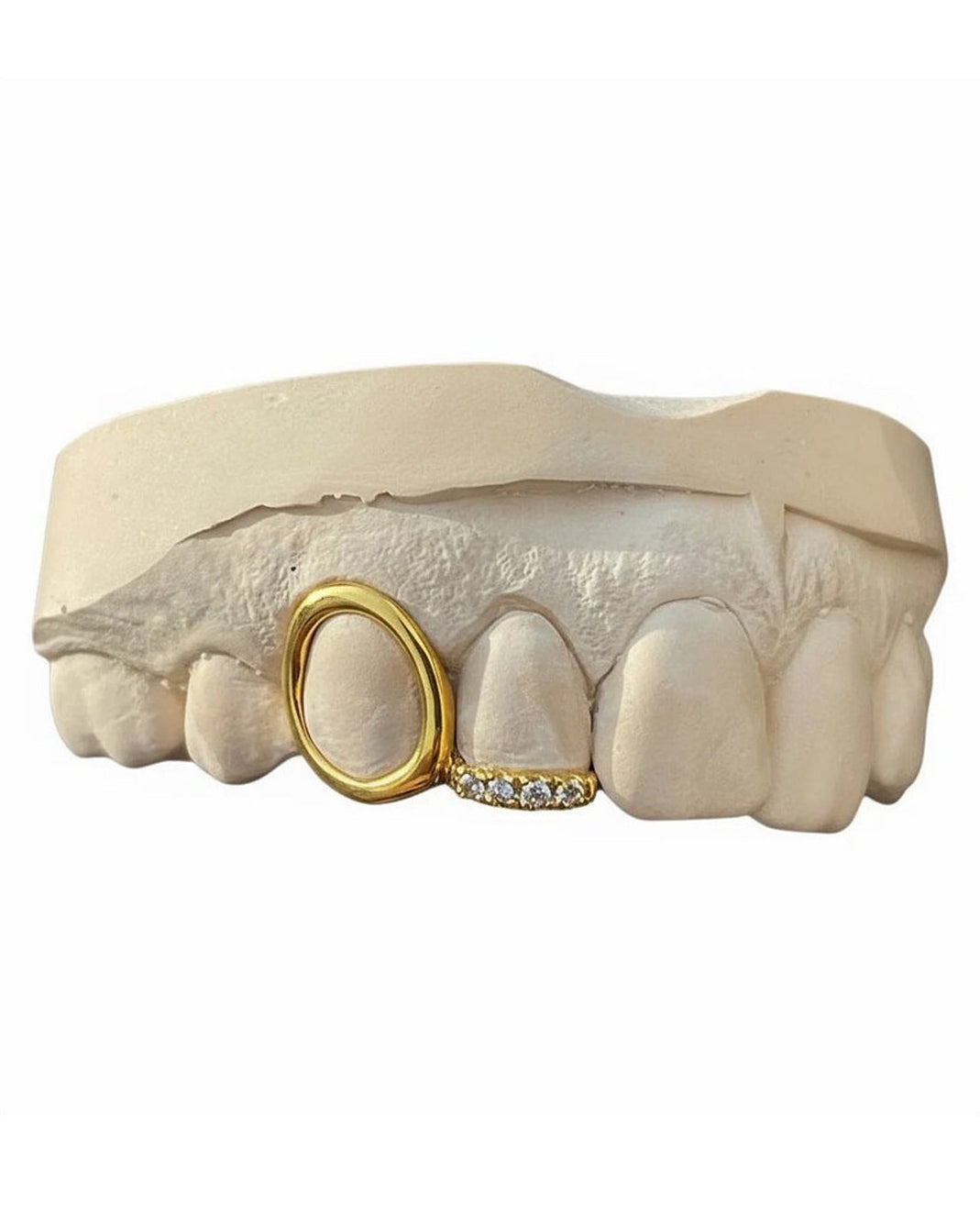 Custom Window Cap Grillz with Swarovski Gemstone
