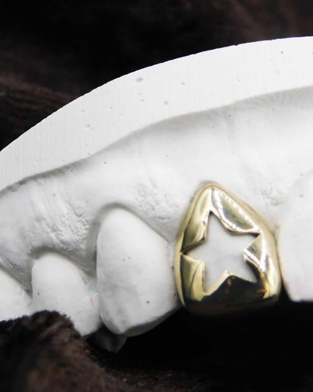 Custom Star Grillz