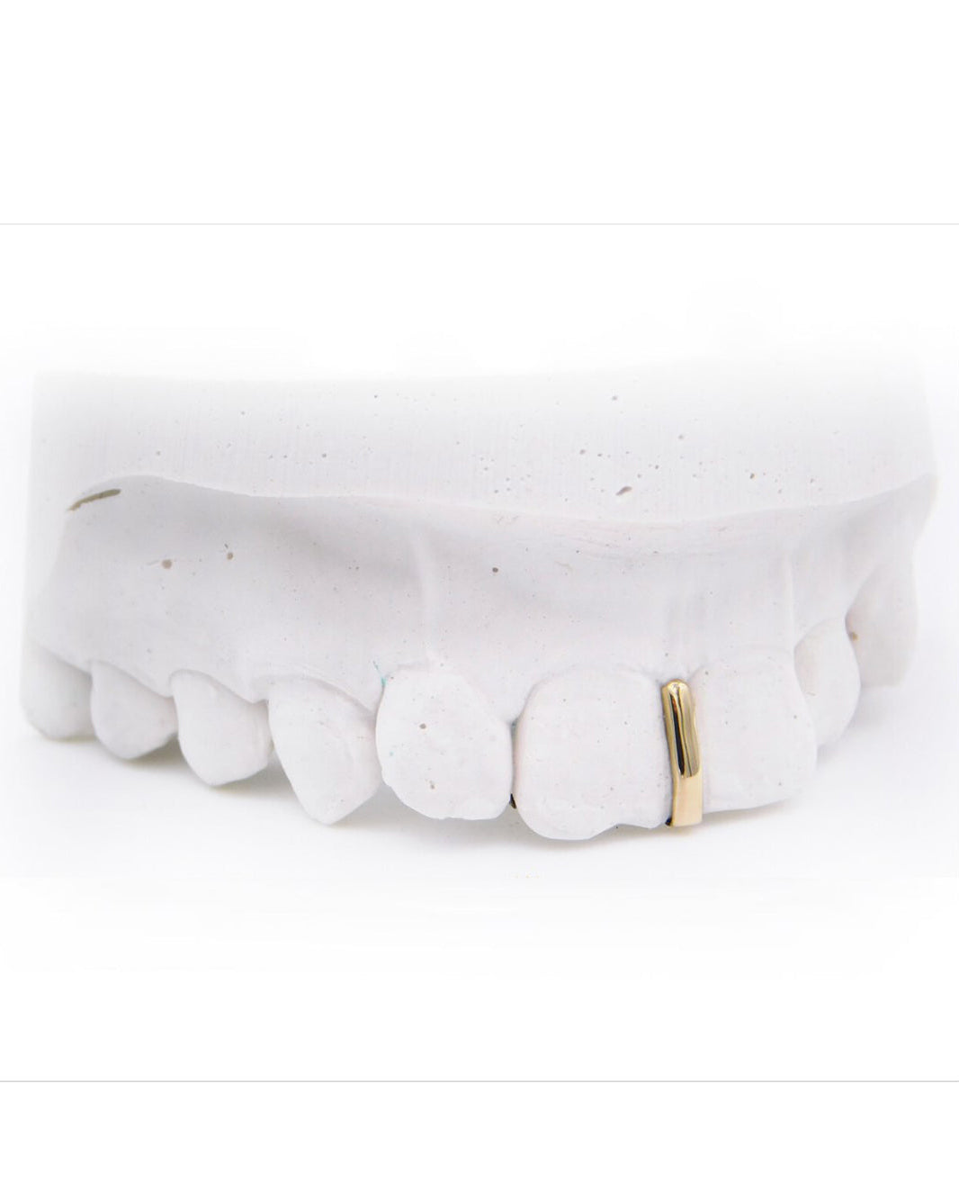 Custom Minimal Drip Grillz
