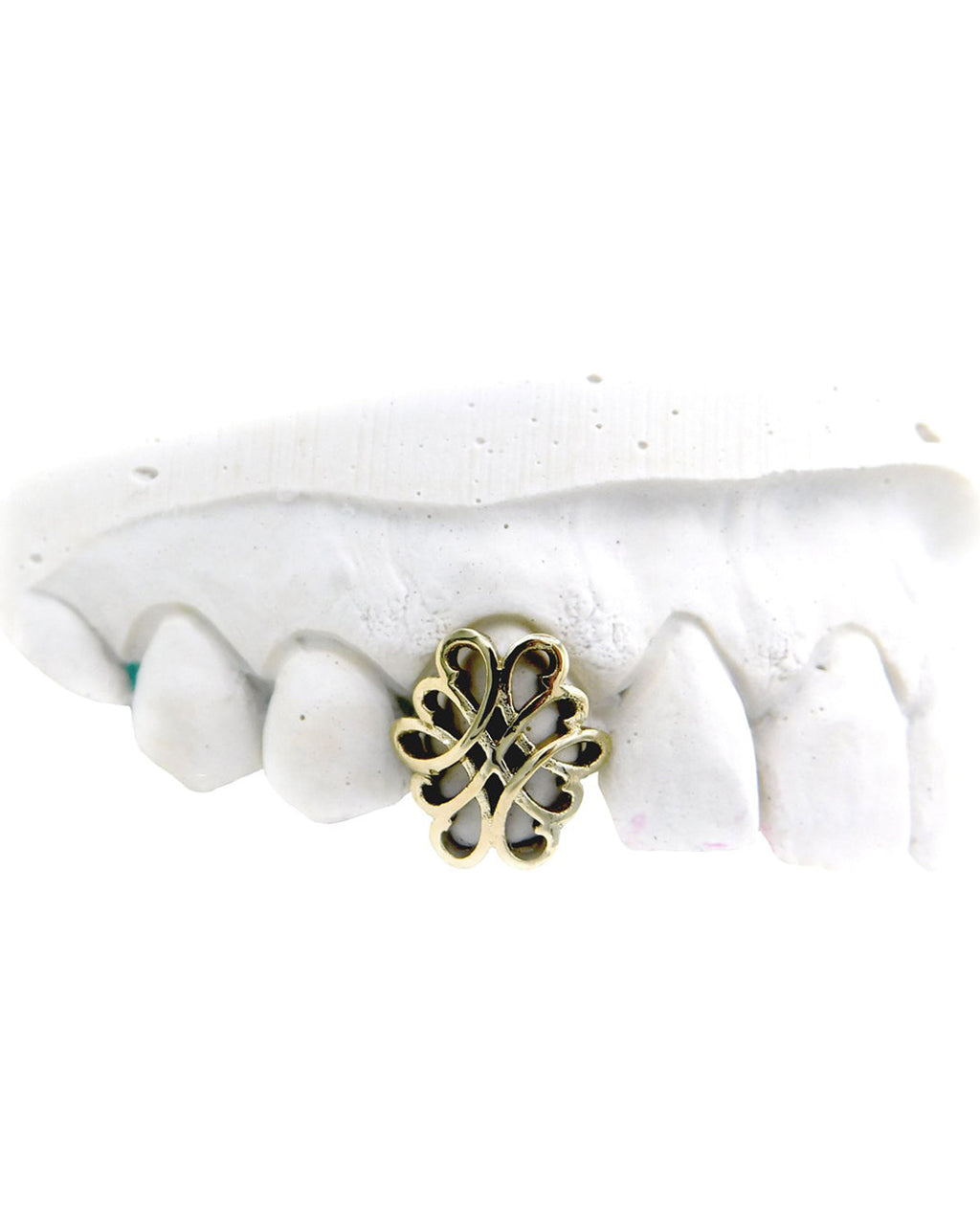 Custom Knot Design Grillz
