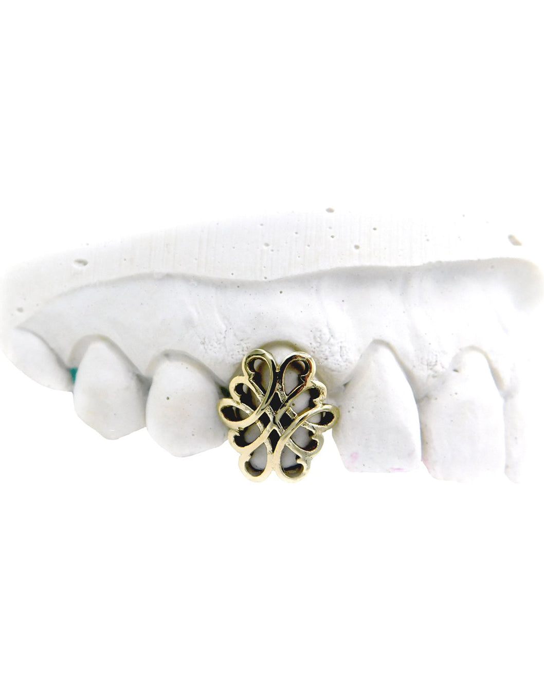 Custom Knot Design Grillz