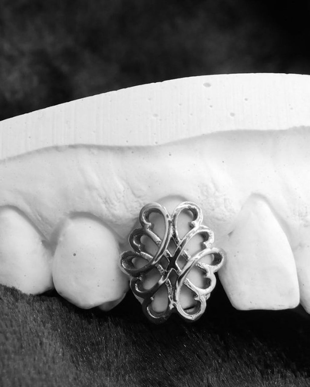 Custom Knot Design Grillz
