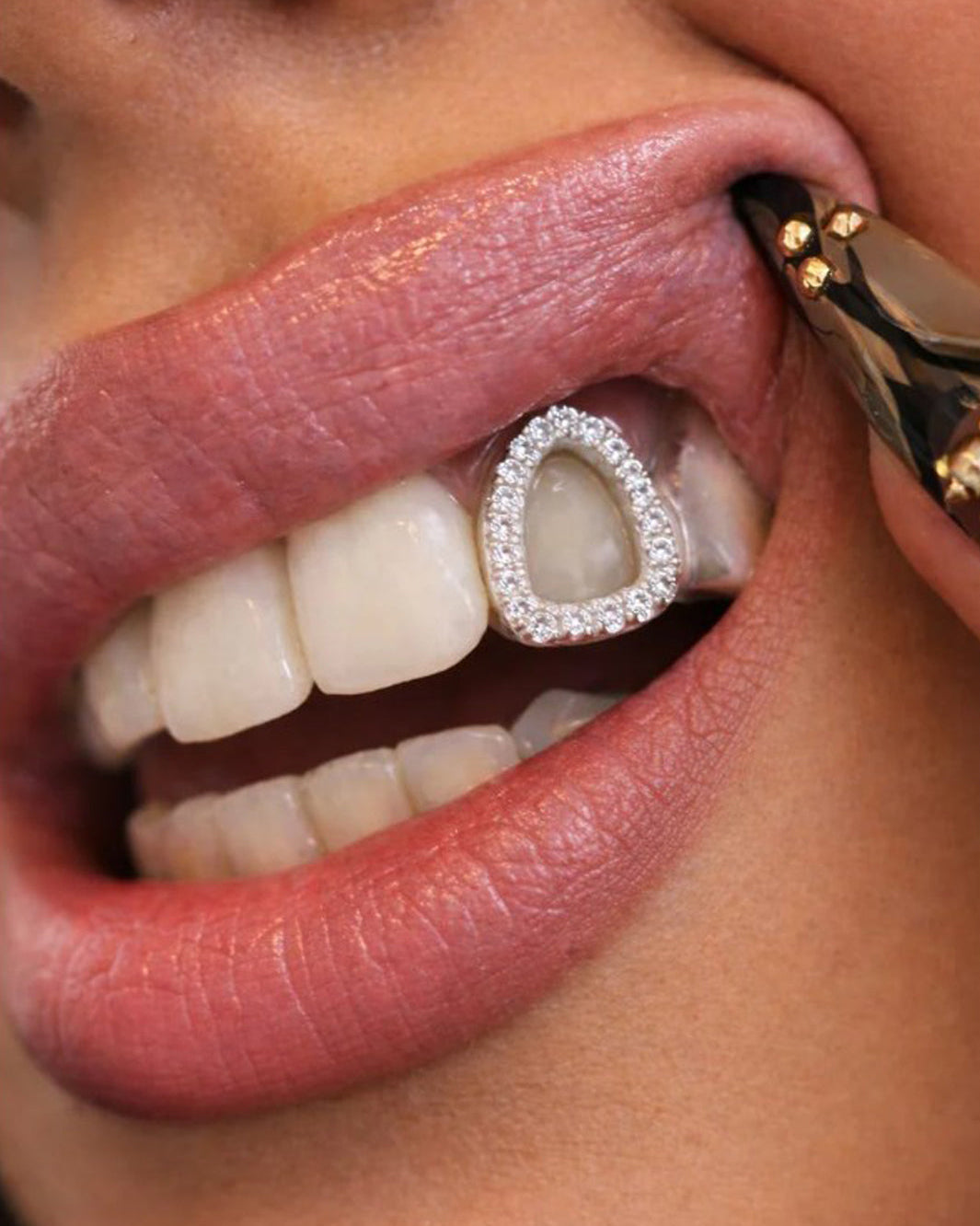 Custom Frame Design Grillz with Swarovski Gemstone