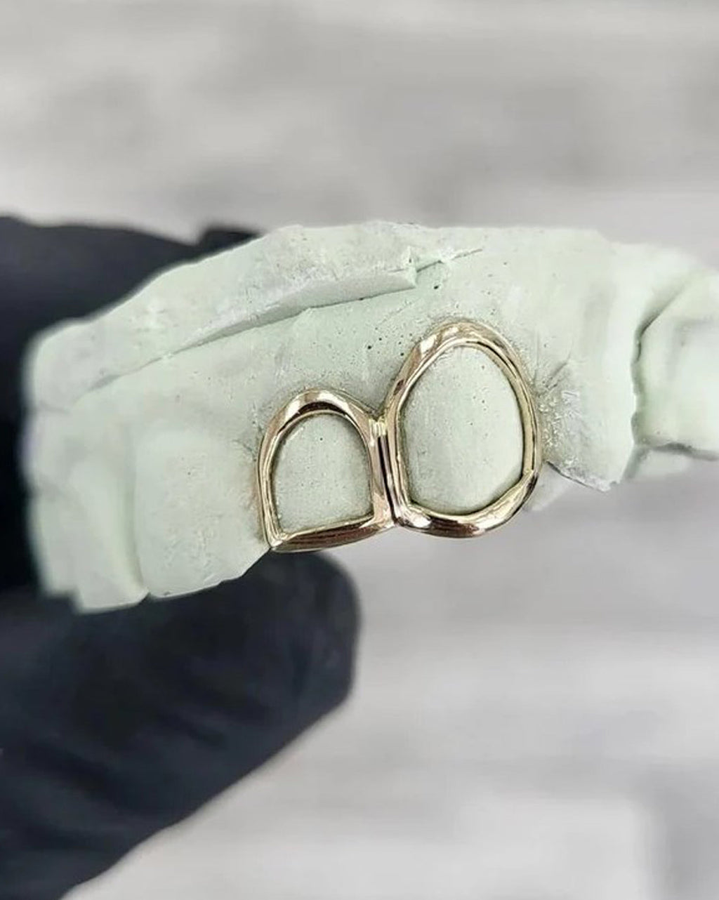 Custom  Frame Design Grillz