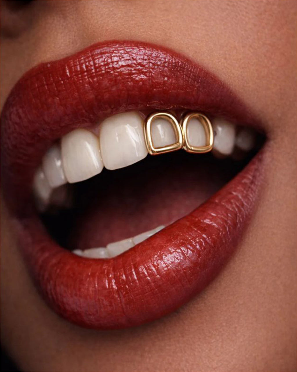Custom  Frame Design Grillz