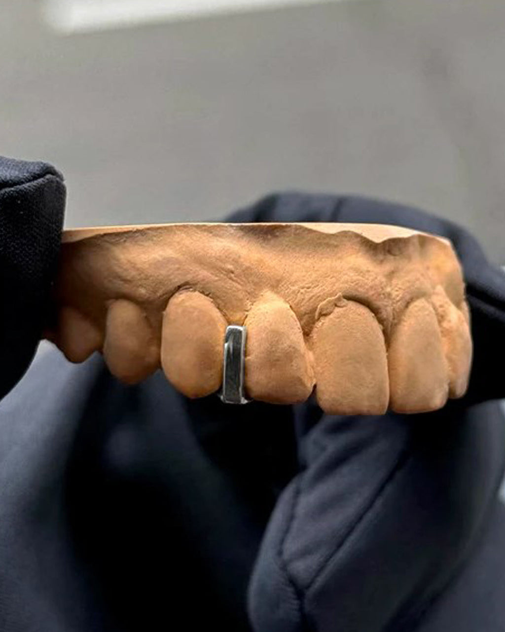 Minimal Band Detail Design Grillz