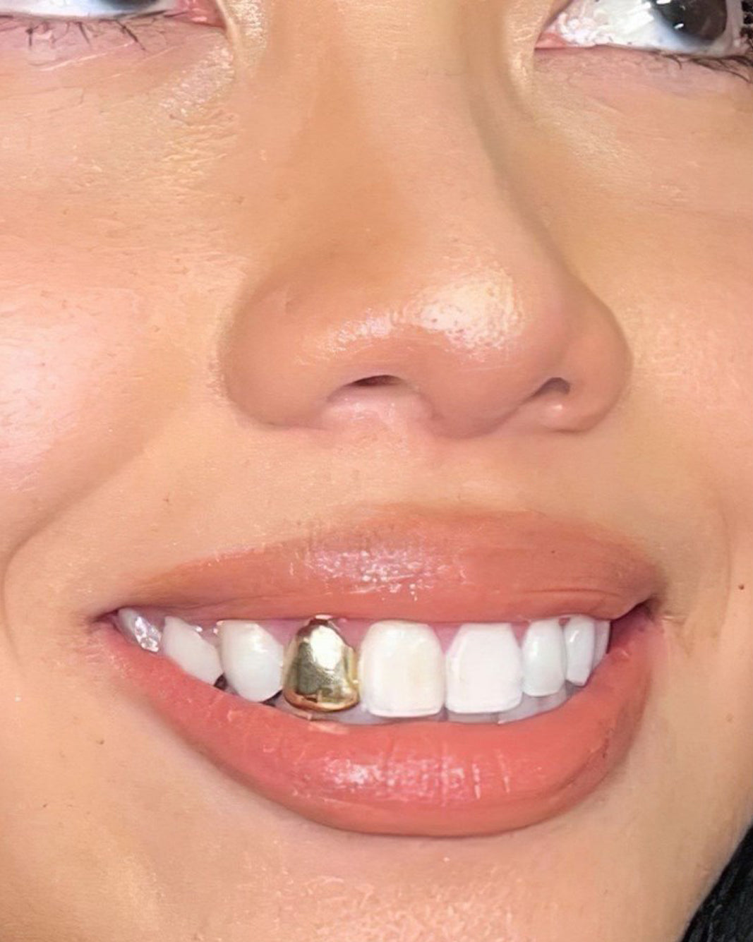 Custom One Piece Grillz