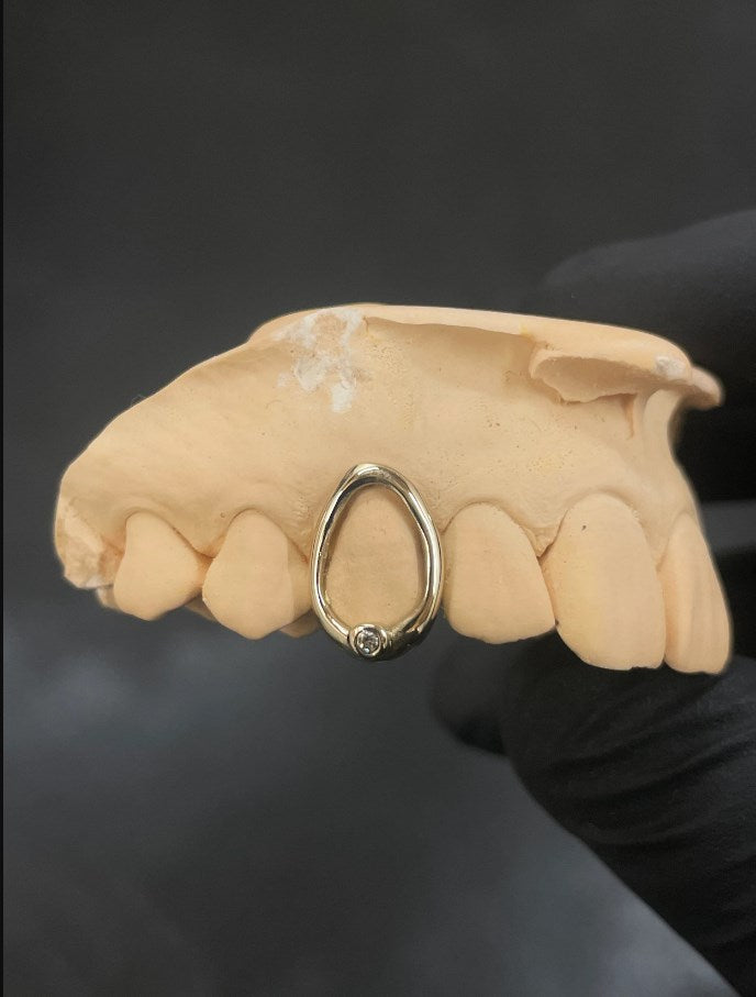 Custom Drop Design Grillz with Swarovski Gemstone