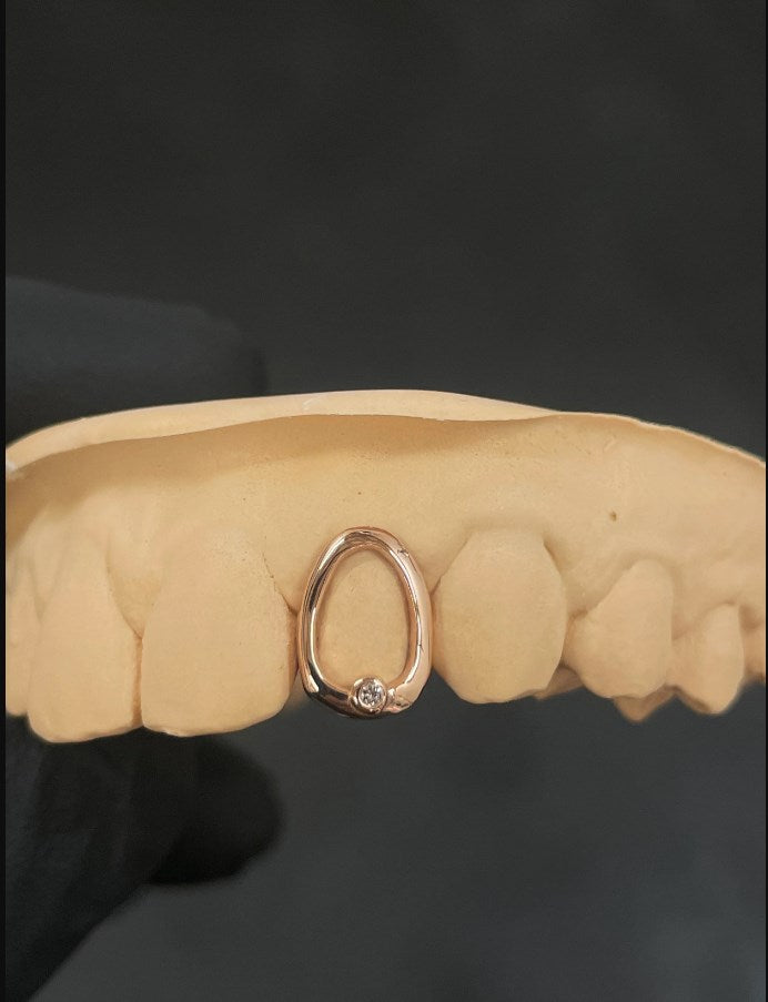 Custom Drop Design Grillz with Swarovski Gemstone
