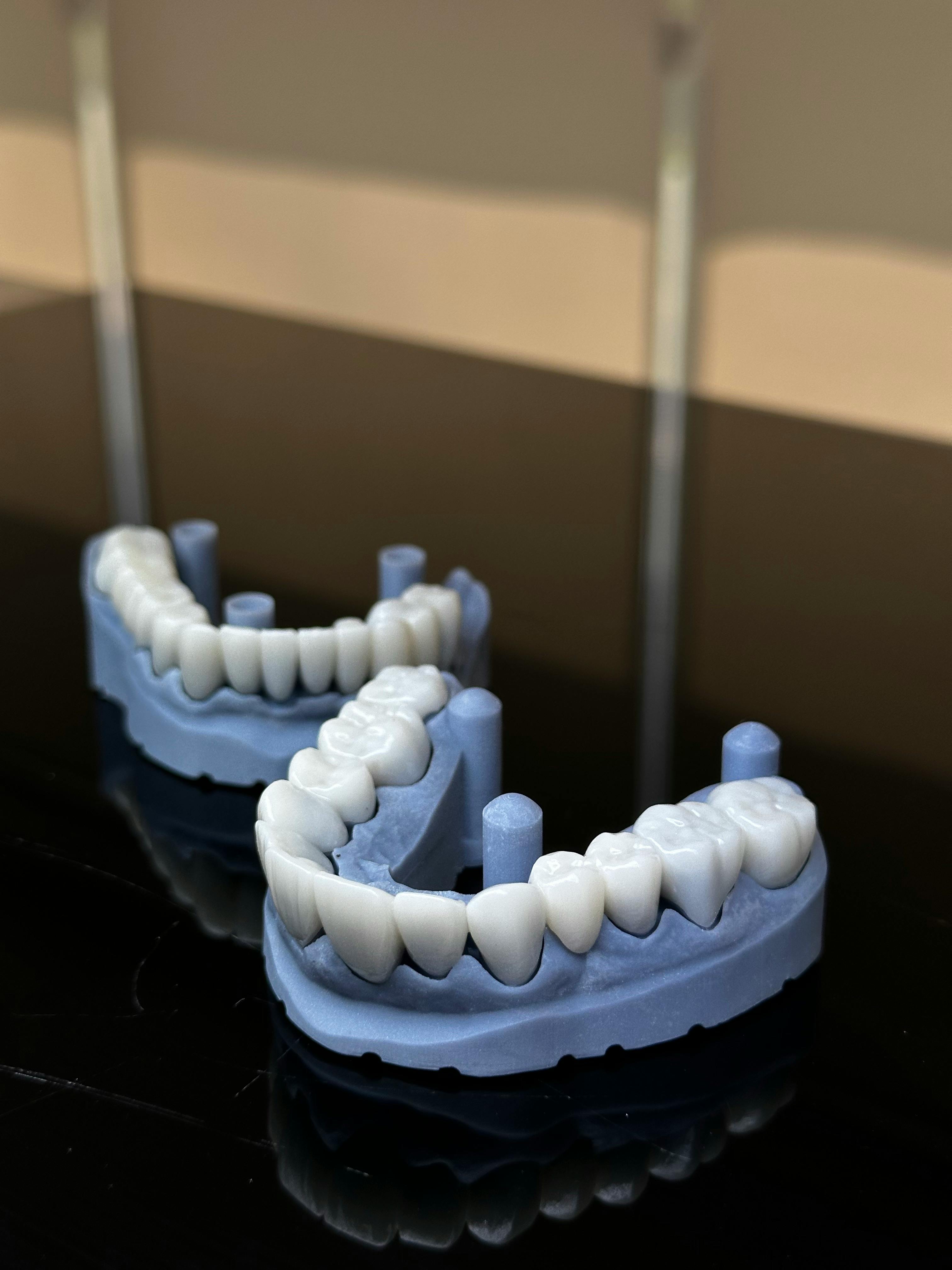 End-to-End Dental Restoration Production