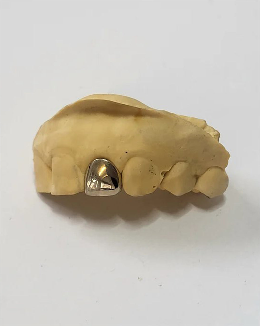 Custom One Piece Grillz