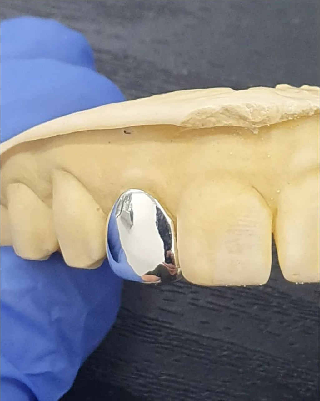 Custom One Piece Grillz