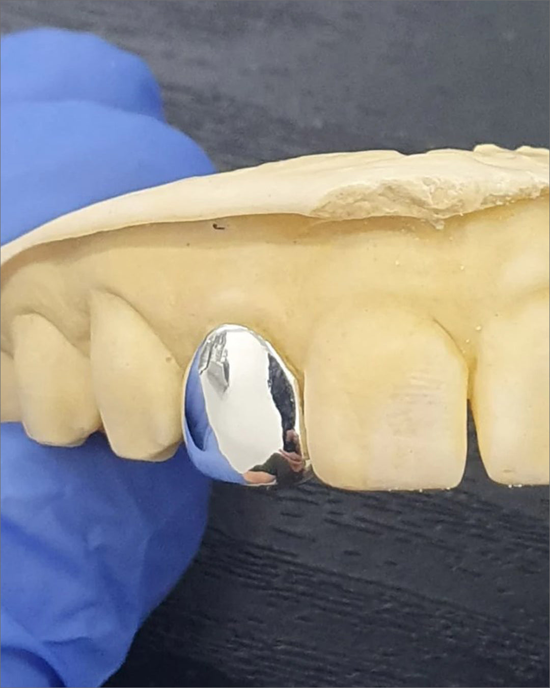 Custom One Piece Grillz