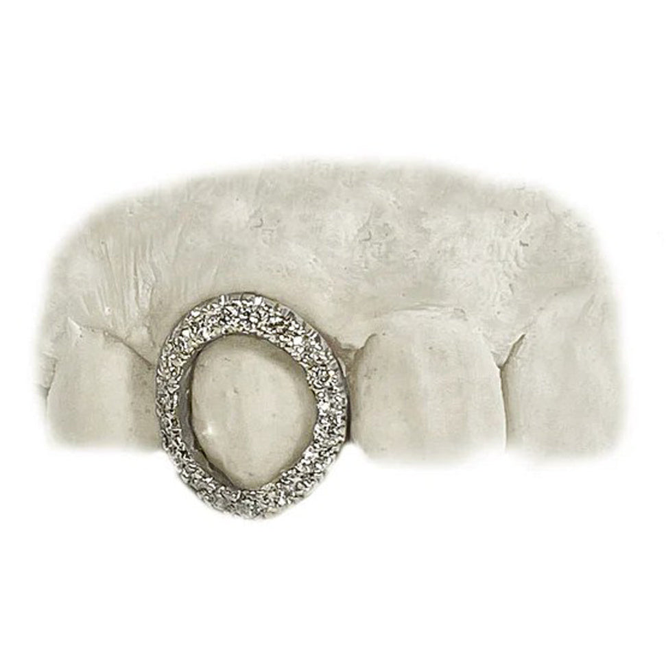 Single Tooth Open Face Diamond Fang Grillz – 14K White Gold Custom Iced Fang Cap