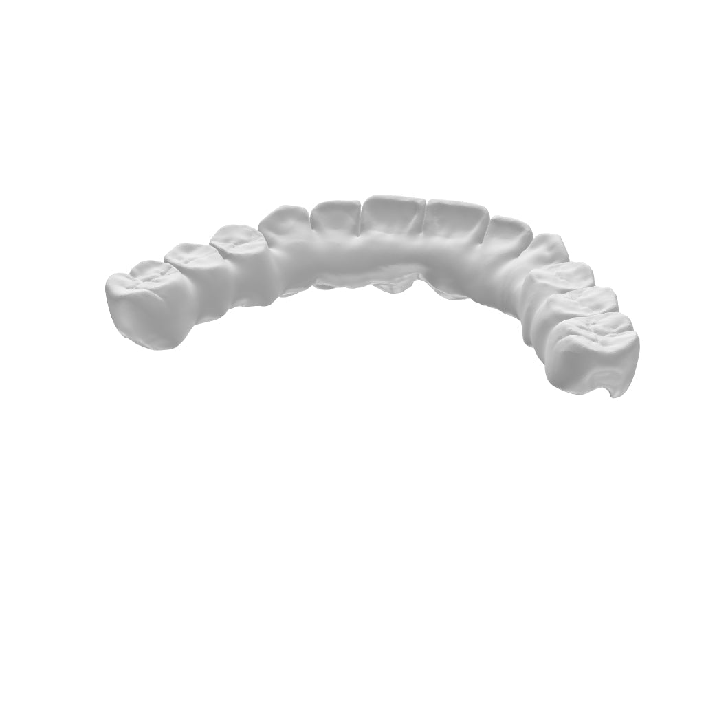 End-to-End Dental Restoration Production