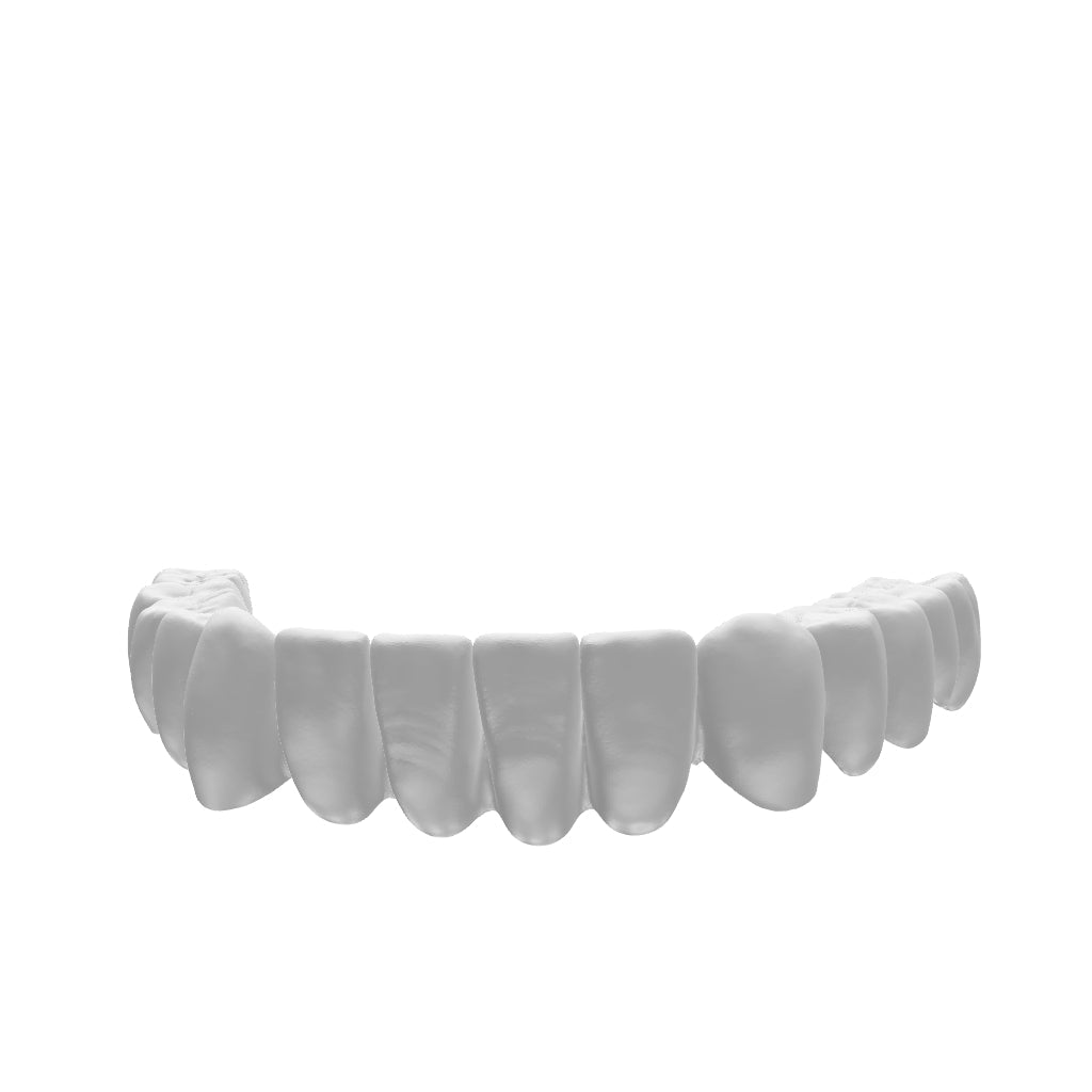 End-to-End Dental Restoration Production
