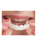 Snap-on Veneers