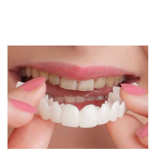 Snap-on Veneers